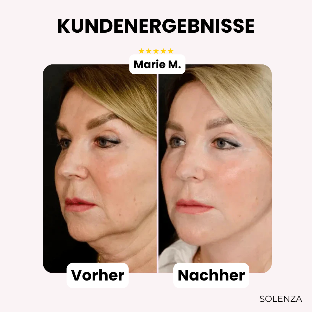 Letzter Tag -50% | GlowLift™ Unsichtbares Gesichtslifting-Band (40 Stück)